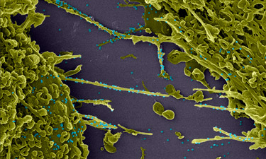 img coronavirus em acao